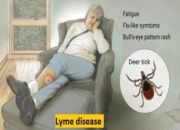 pests and diseases lyme-disease